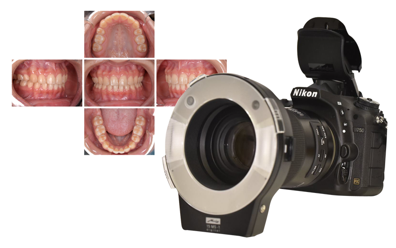 口腔内写真撮影用カメラ